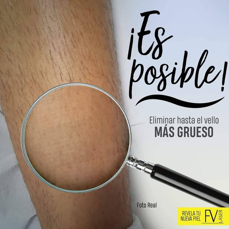 Fv Láser Nails Beauty 17