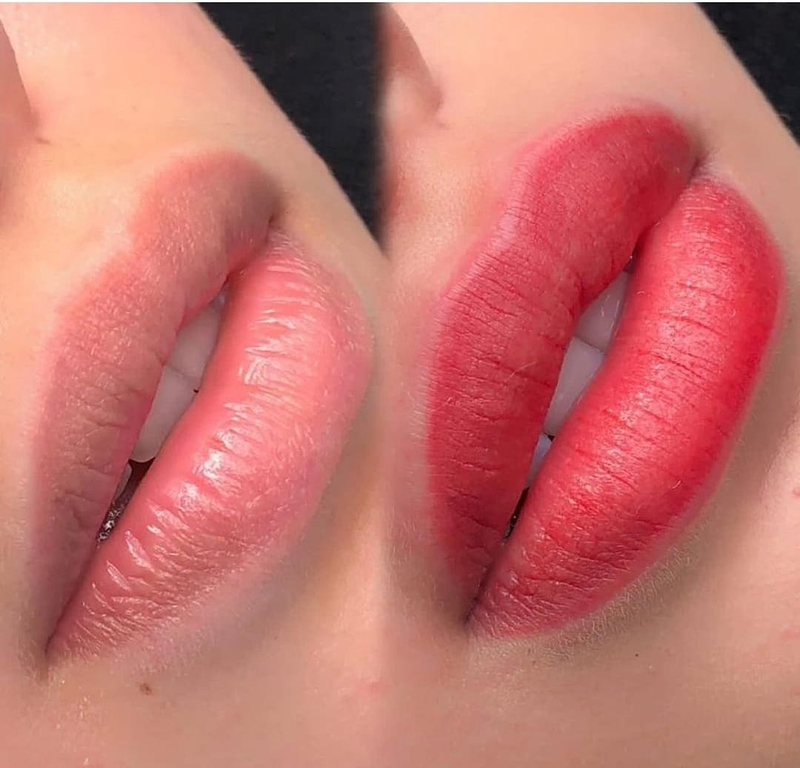 Fv Láser Nails Beauty 4