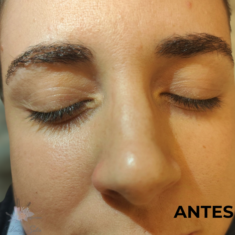 Fv Láser Nails Beauty 42