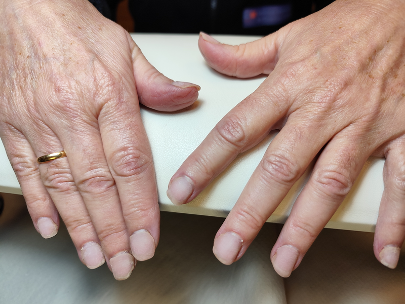 Fv Láser Nails Beauty 59