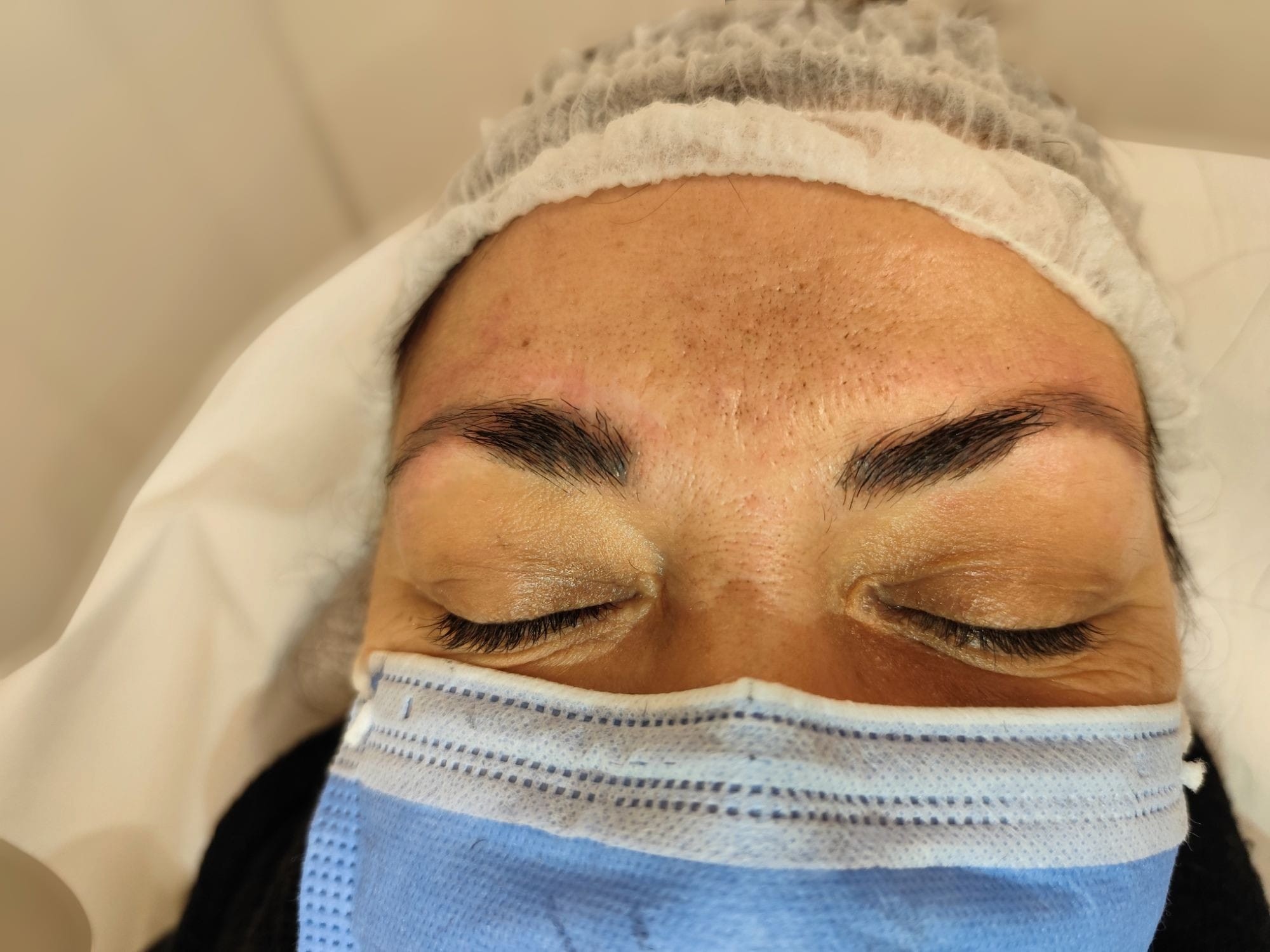 Fv Láser Nails Beauty 68