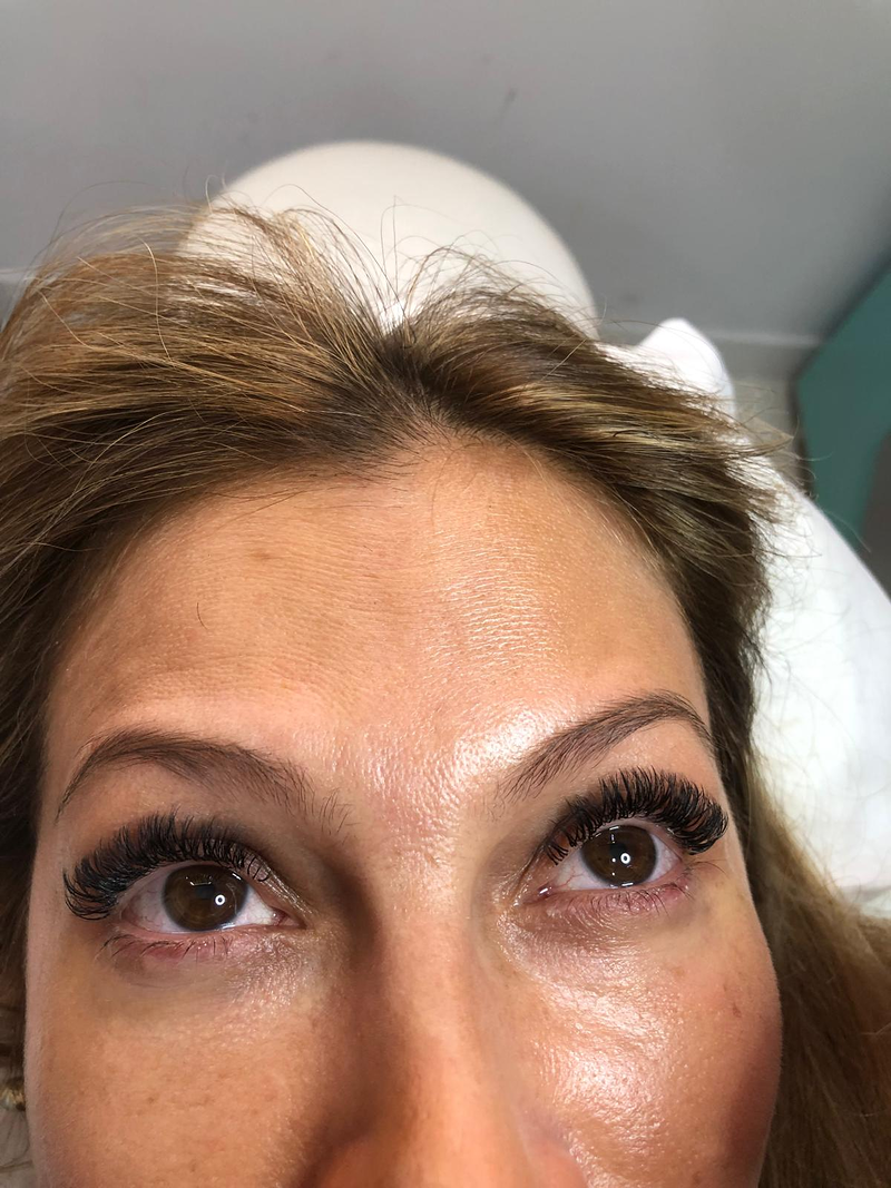 Fv Láser Nails Beauty 49