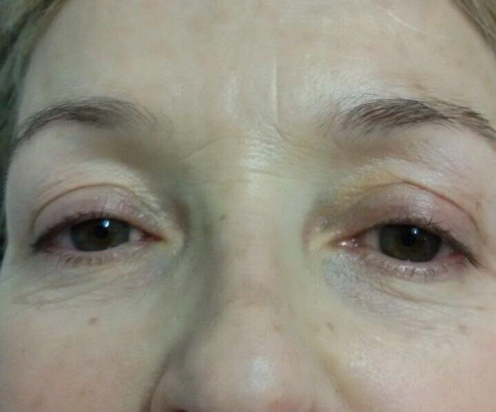 Fv Láser Nails Beauty 57