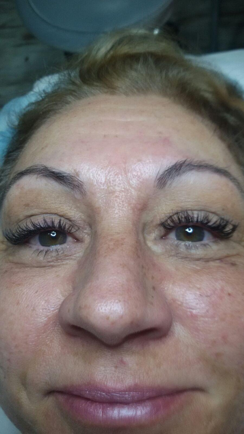 Fv Láser Nails Beauty 48