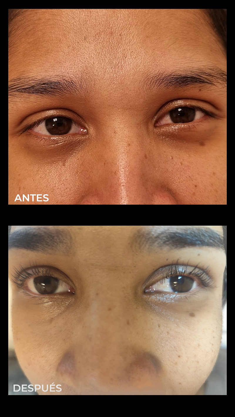 Fv Láser Nails Beauty 25