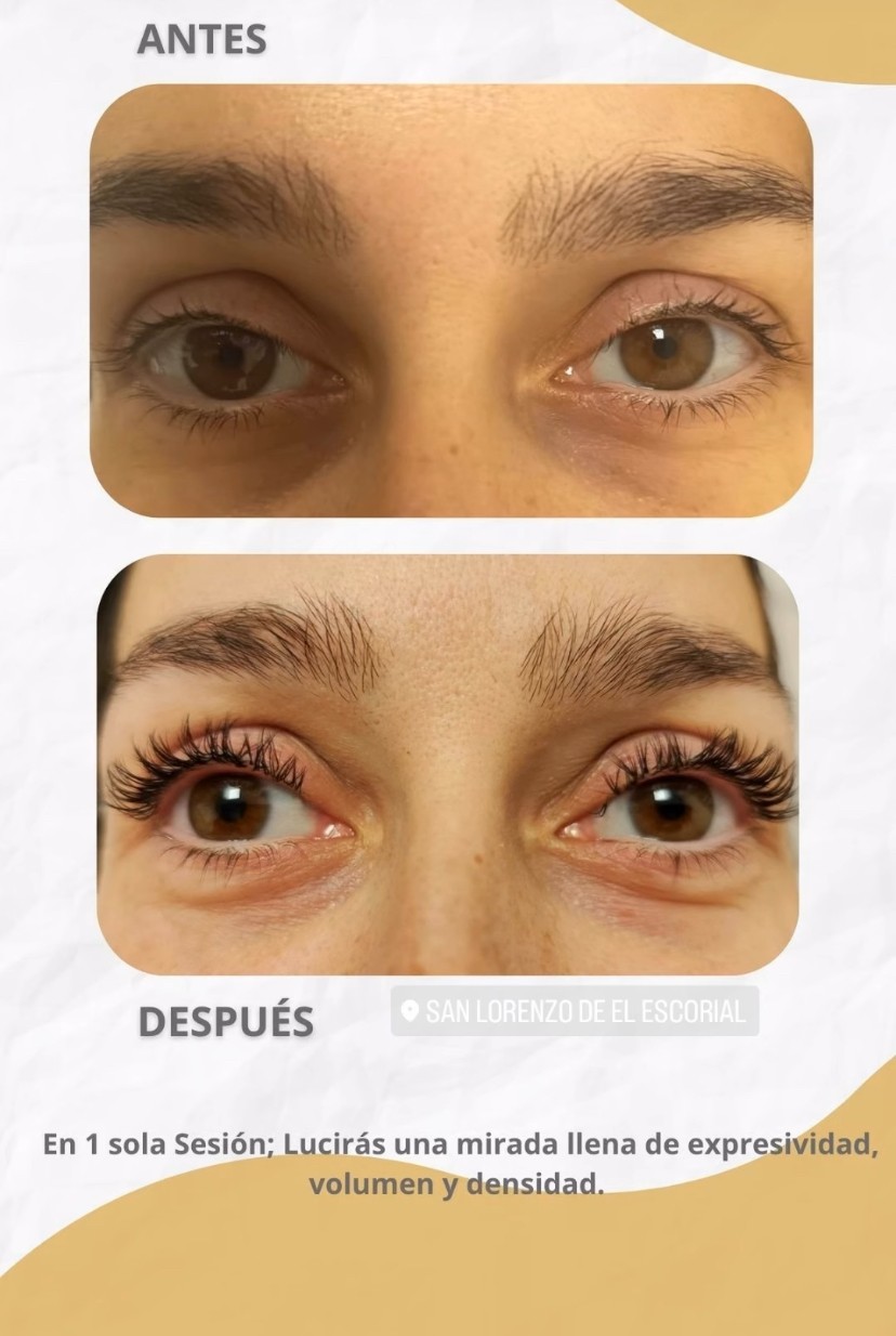 Fv Láser Nails Beauty 66