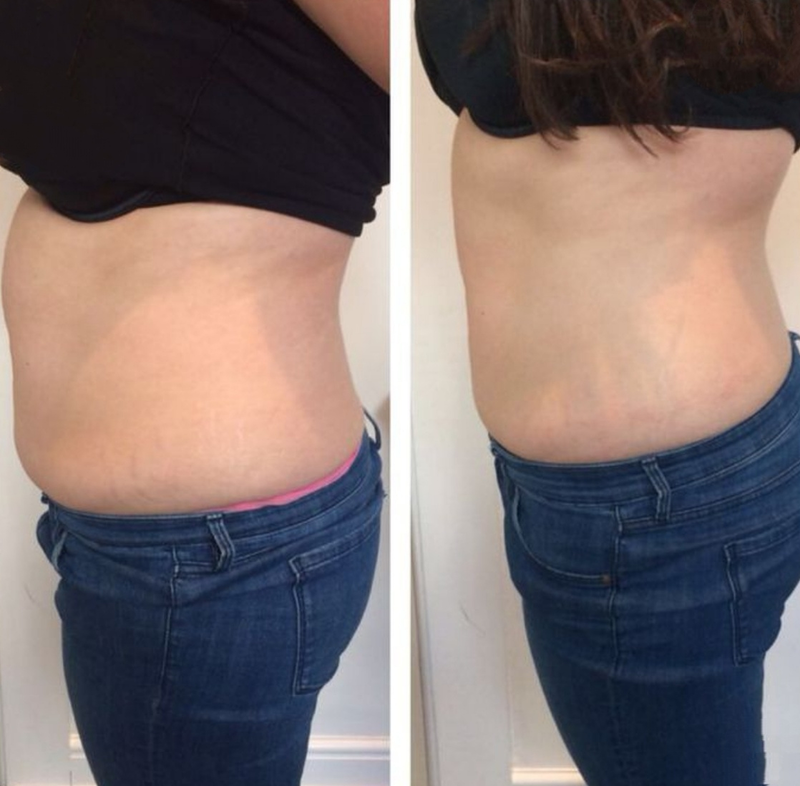 Fv Láser Nails Beauty 18