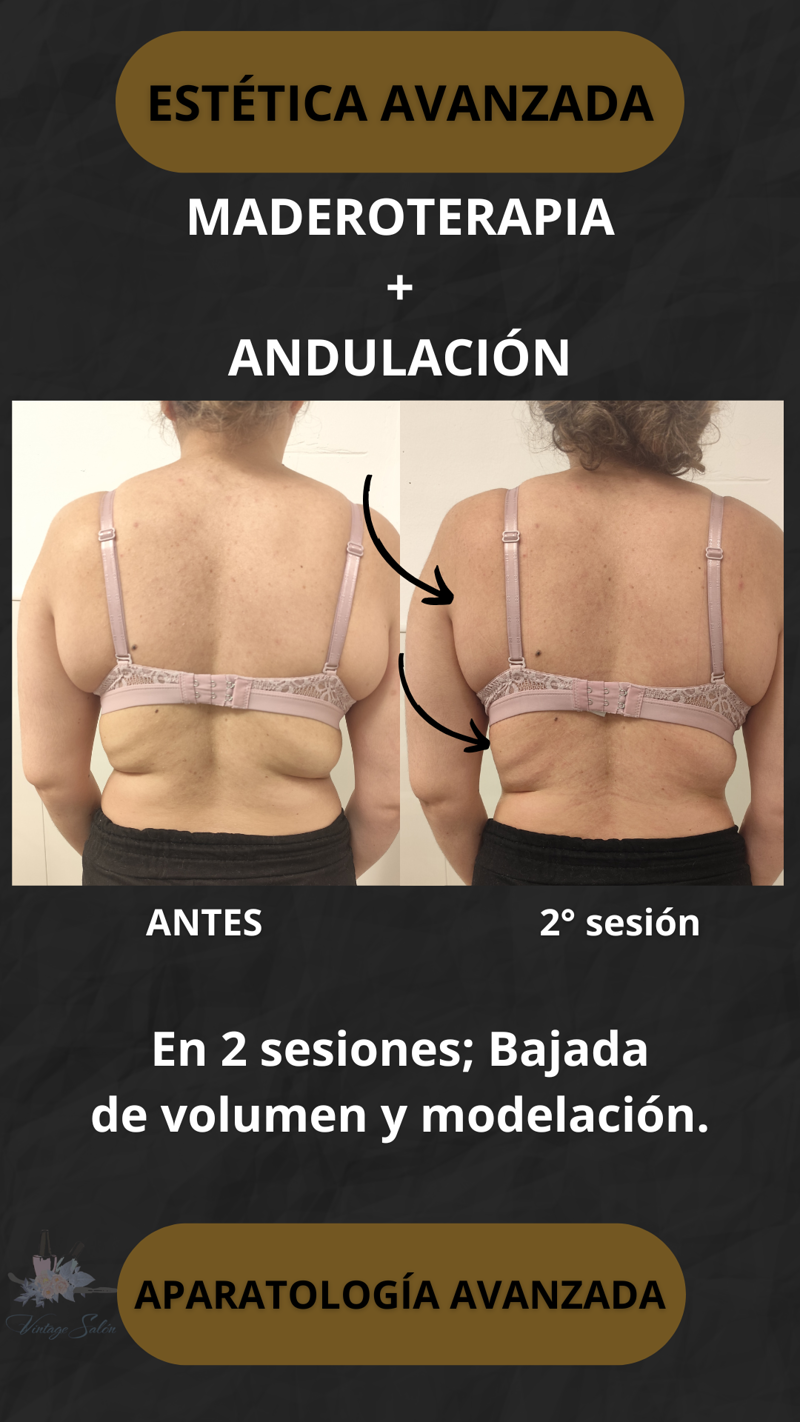 Fv Láser Nails Beauty 56