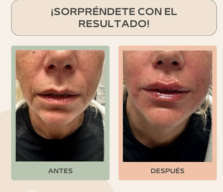 Dermo Ink Vlc València