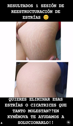 Galería de imágenes