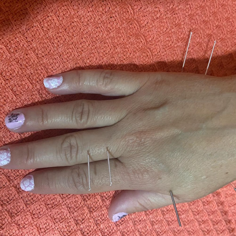 Acupuntura Avanzada Madrid 8