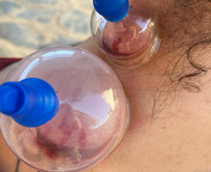 Acupuntura Avanzada Madrid 21