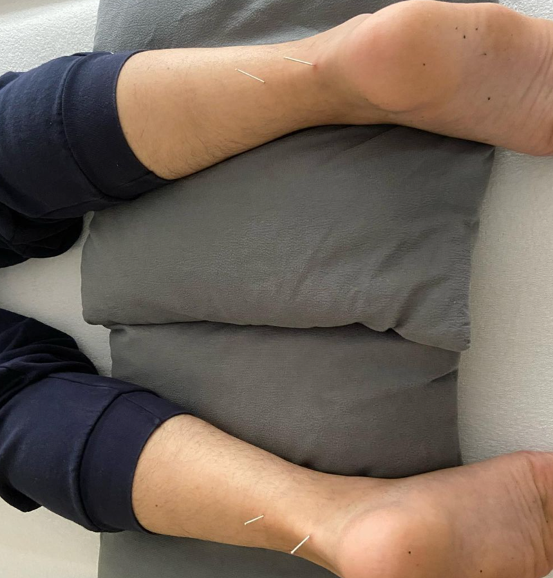 Acupuntura Avanzada Madrid 10