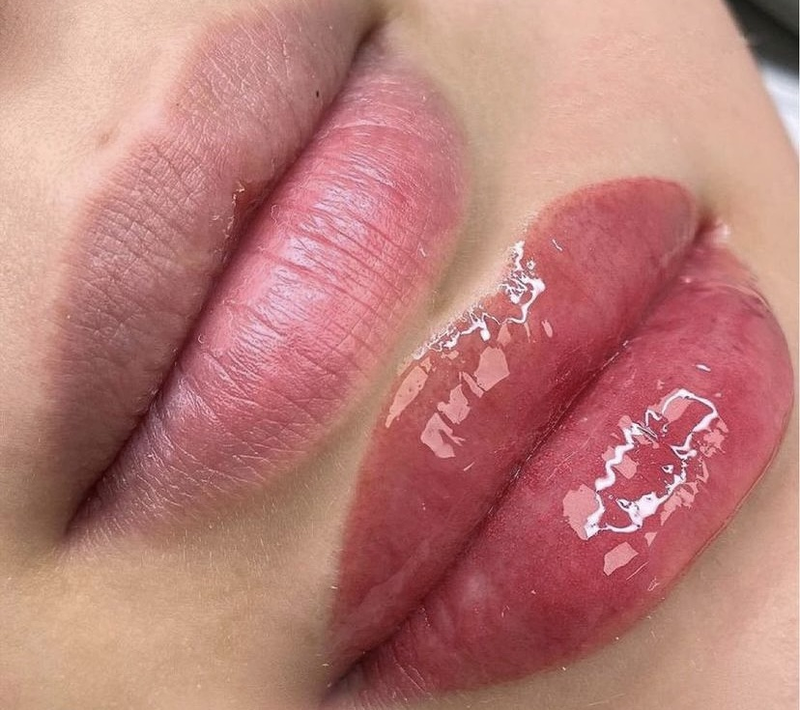 Kumiko Centro Estetica Global 2