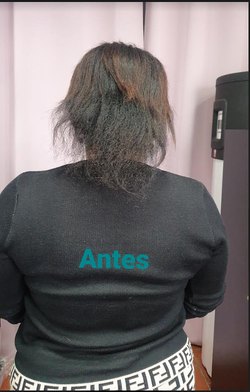 EXTENSIONES DE NUDO Kary 3