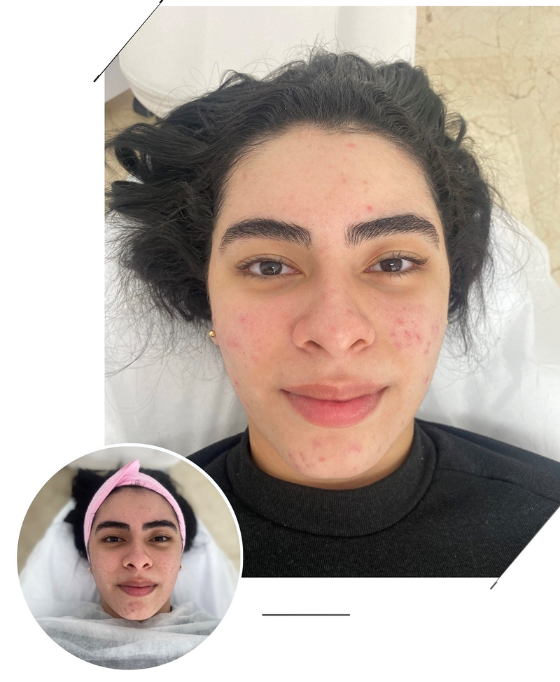 EBA Beauty Marbella By Elena Badini 4