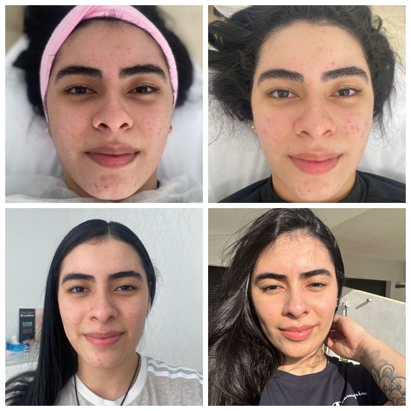 EBA Beauty Marbella By Elena Badini 3