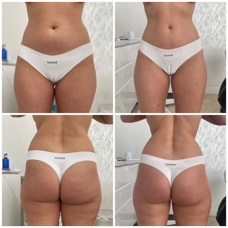 EBA Beauty Marbella By Elena Badini 7