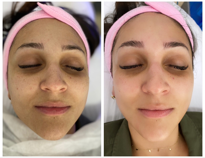 EBA Beauty Marbella By Elena Badini 2