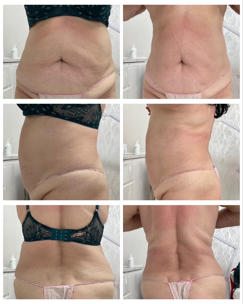 EBA Beauty Marbella By Elena Badini 11