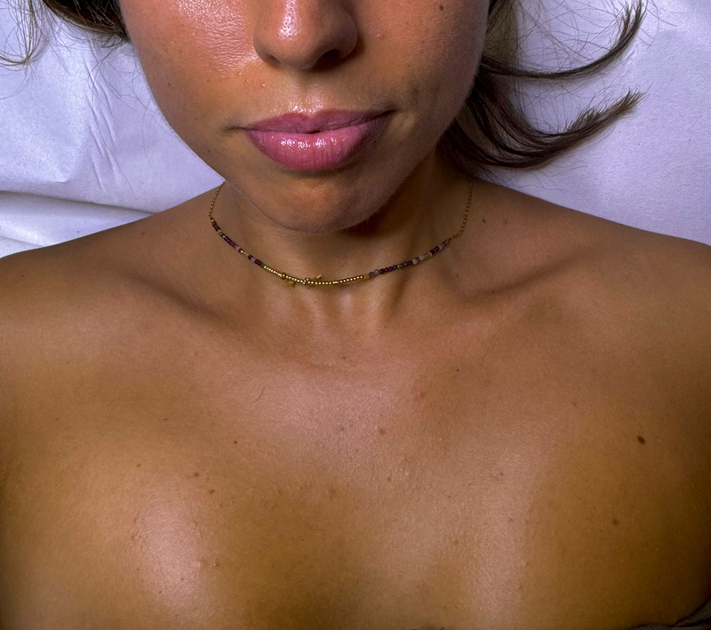 Centro de Estética Avanzada Merche 3