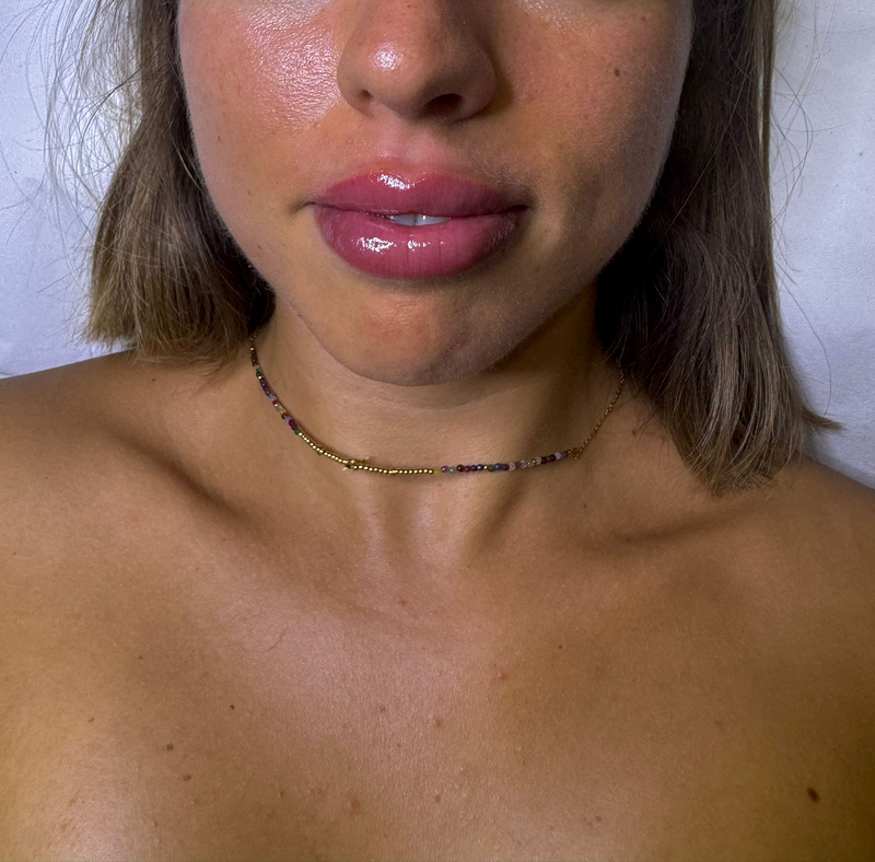 Centro de Estética Avanzada Merche 4