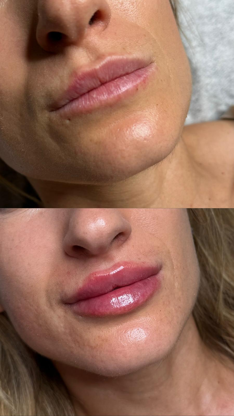 Centro de Estética Avanzada Merche 5