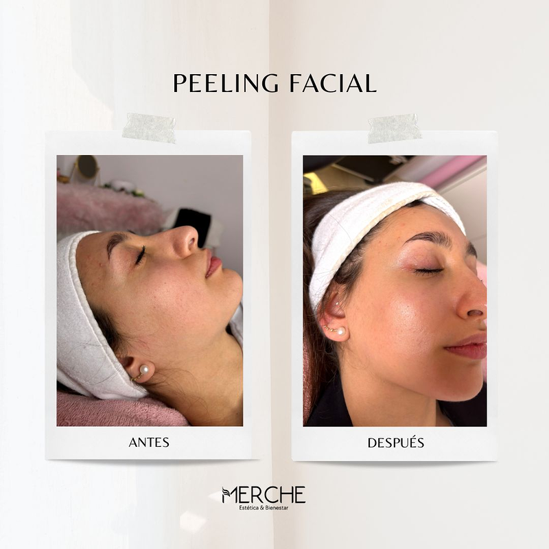 Centro de Estética Avanzada Merche 7