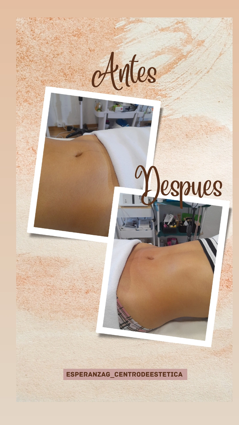 Esperanza Guzm&aacute;n Profesional de Est&eacute;tica 7