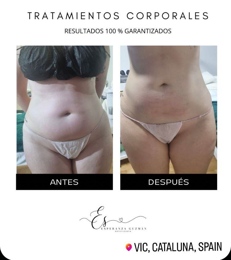 Esperanza Guzm&aacute;n Profesional de Est&eacute;tica 2