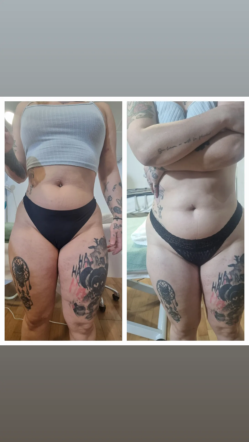 Esperanza Guzm&aacute;n Profesional de Est&eacute;tica 6