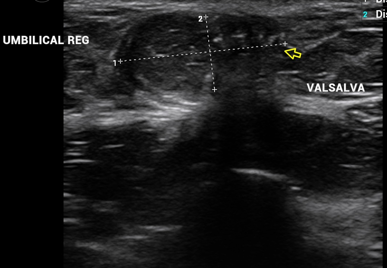 Alejandro Fidel Valma&ntilde;a S&aacute;nchez 16