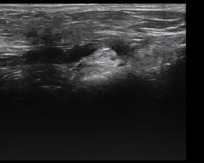 Alejandro Fidel Valma&ntilde;a S&aacute;nchez 19