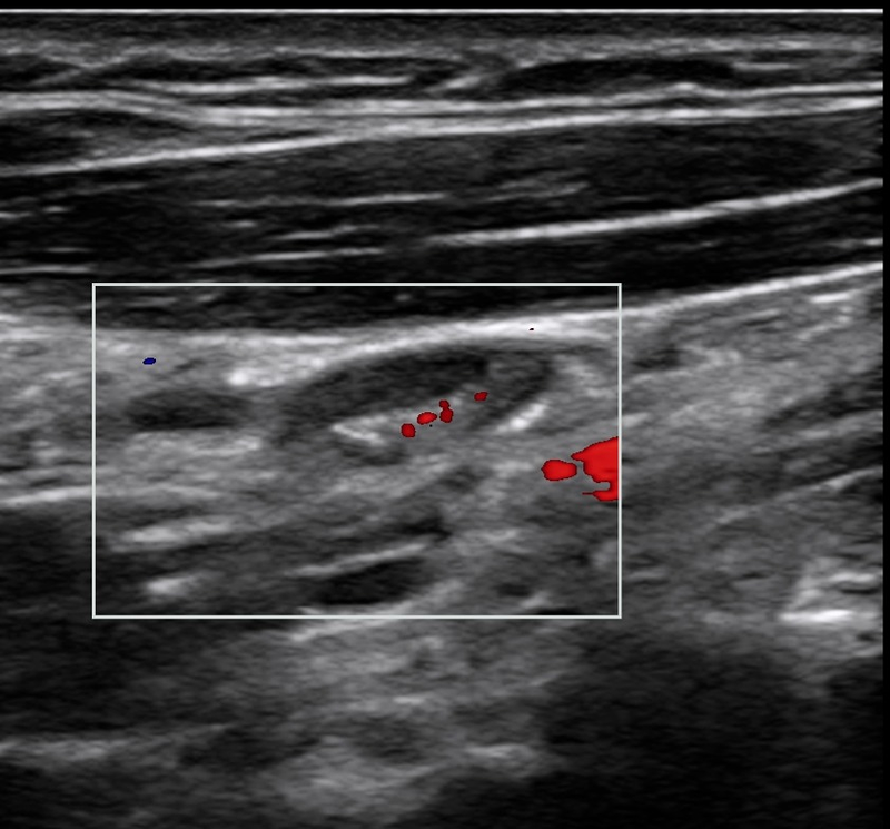 Alejandro Fidel Valma&ntilde;a S&aacute;nchez 20