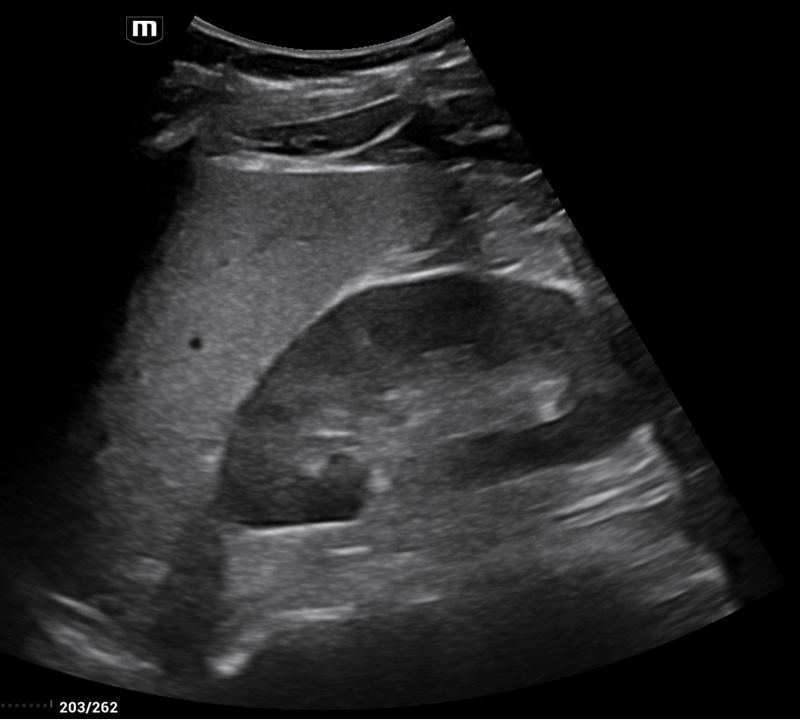 Alejandro Fidel Valma&ntilde;a S&aacute;nchez 18