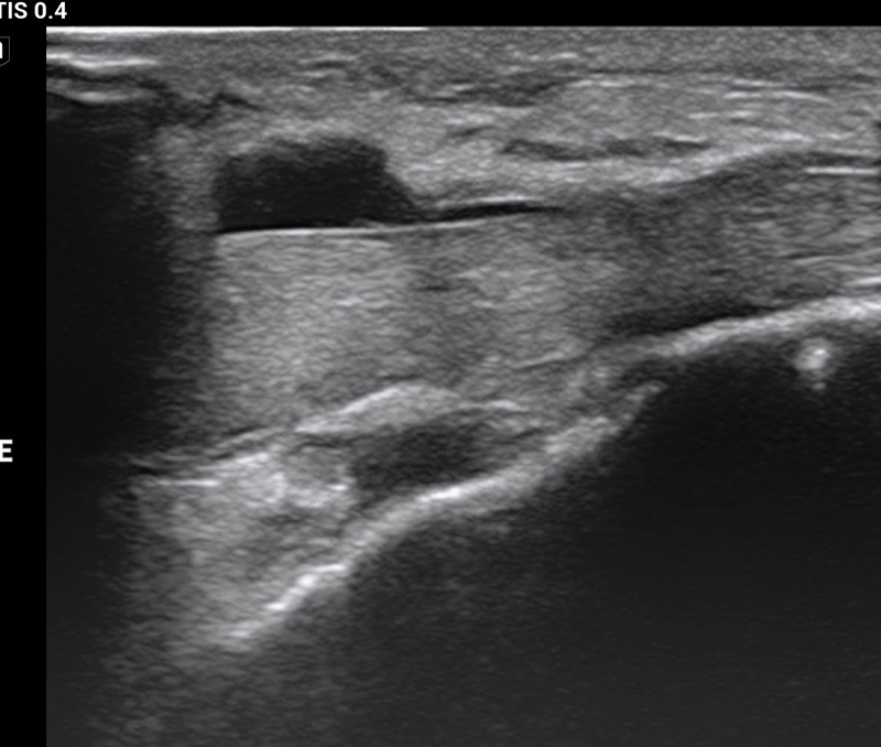 Alejandro Fidel Valma&ntilde;a S&aacute;nchez 11