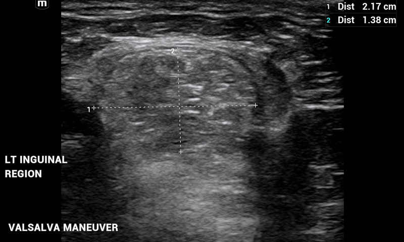 Alejandro Fidel Valma&ntilde;a S&aacute;nchez 17