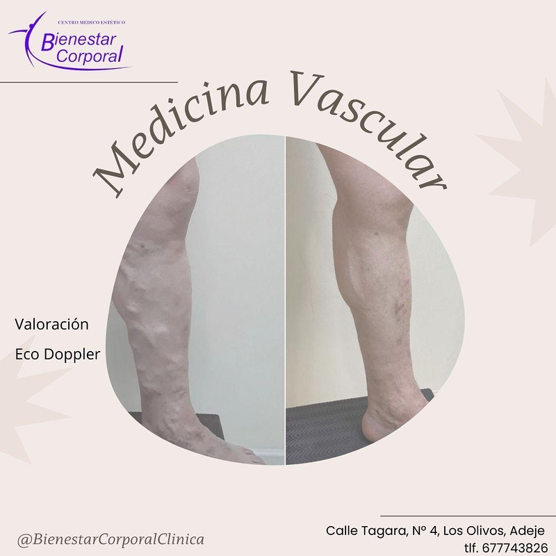 Cl&iacute;nica Bienestar Corporal Adeje 6