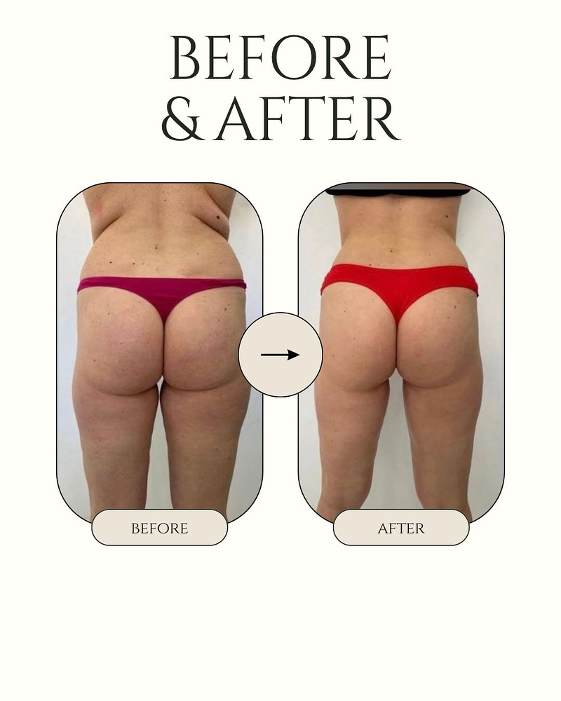 HOLLYWOOD BODY&FACE 6