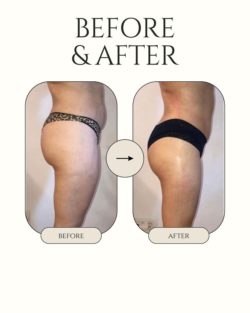 HOLLYWOOD BODY&FACE 7