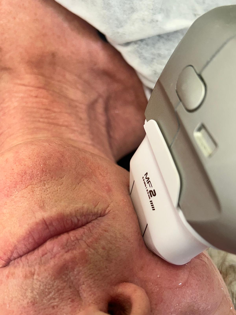 DCG Est&eacute;tica Avanzada 5