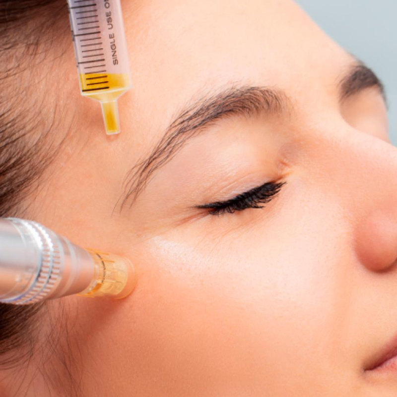 DCG Est&eacute;tica Avanzada 2