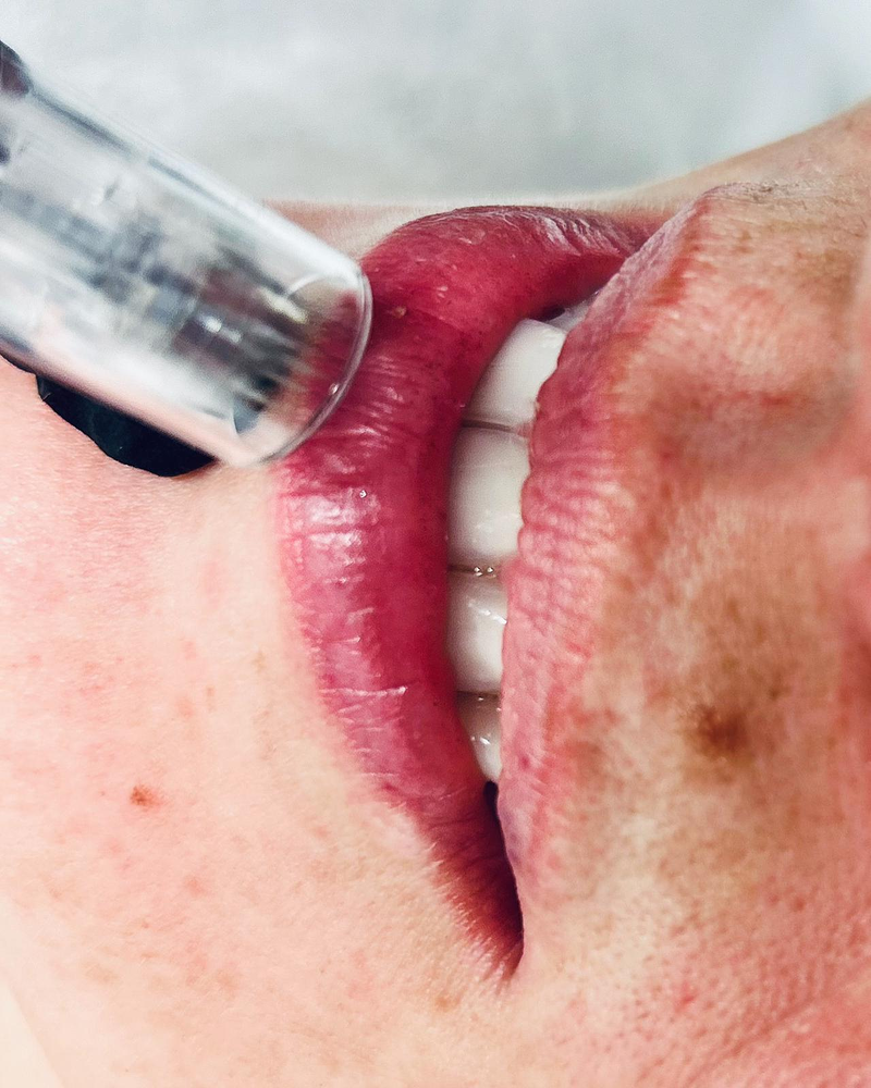 DCG Est&eacute;tica Avanzada 4