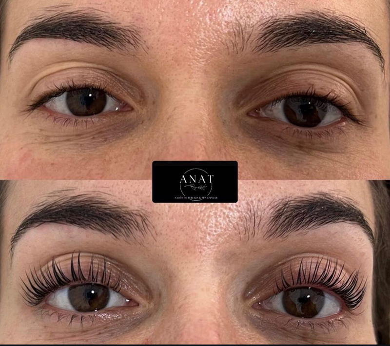 ANAT Belleza & Spa Capilar 4