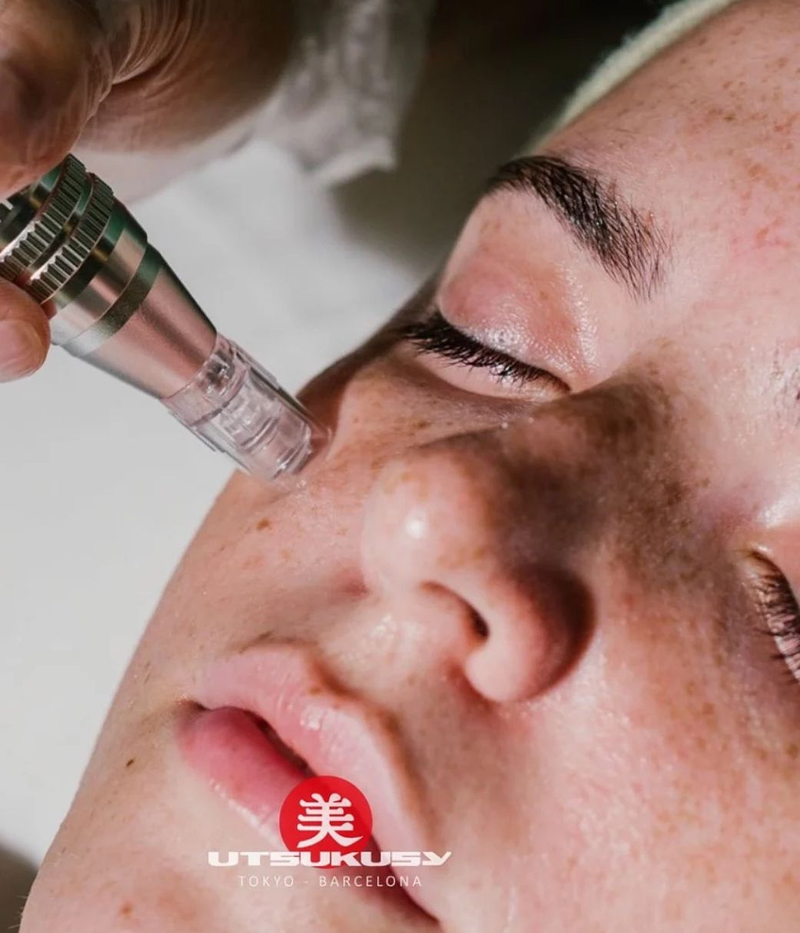 ANAT Belleza & Spa Capilar 10