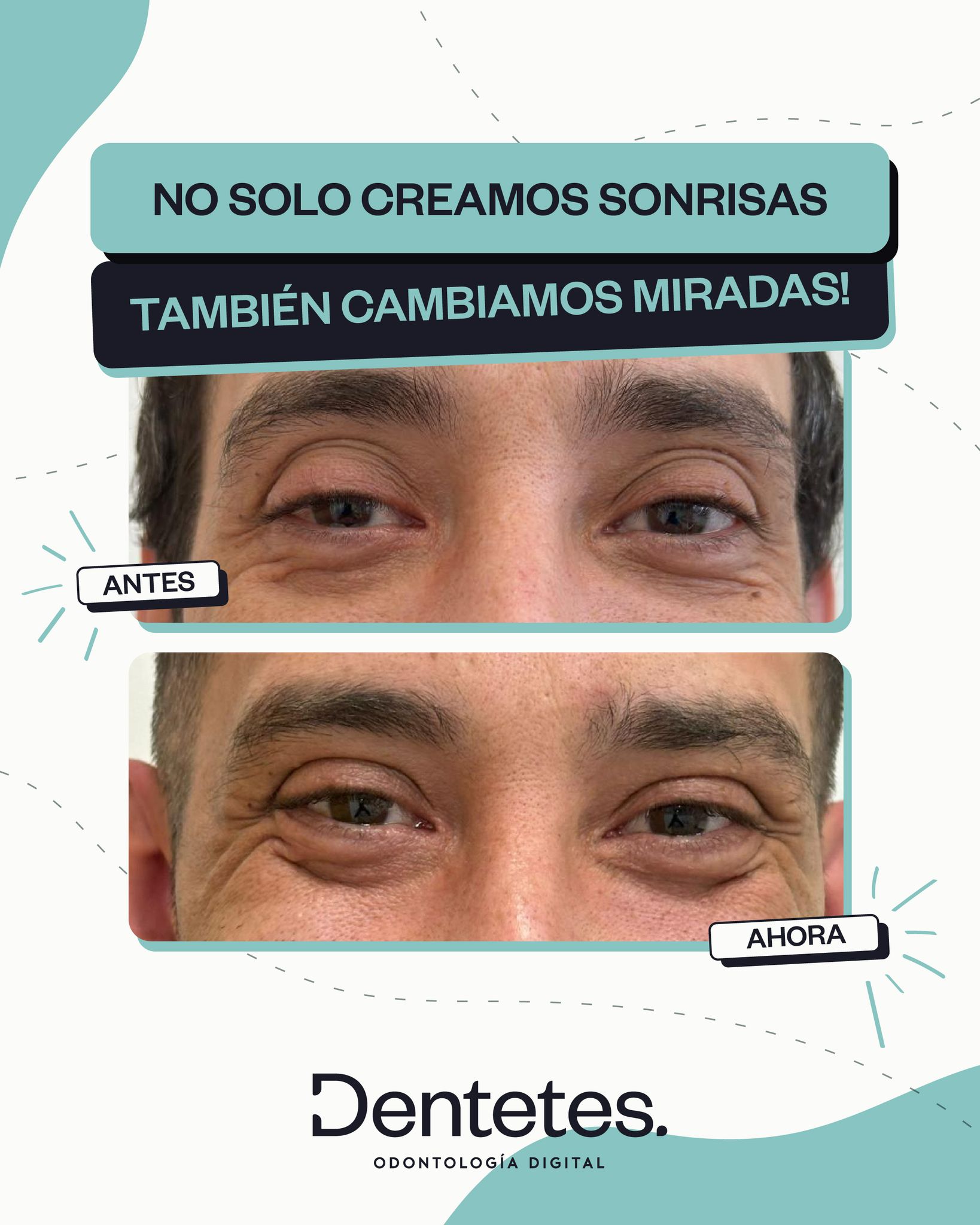 Dentetes Valencia 15