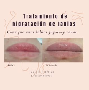Idalgis Est&eacute;tica ESTETICA: CENTROS