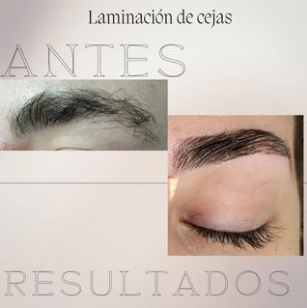 Idalgis Est&eacute;tica 2