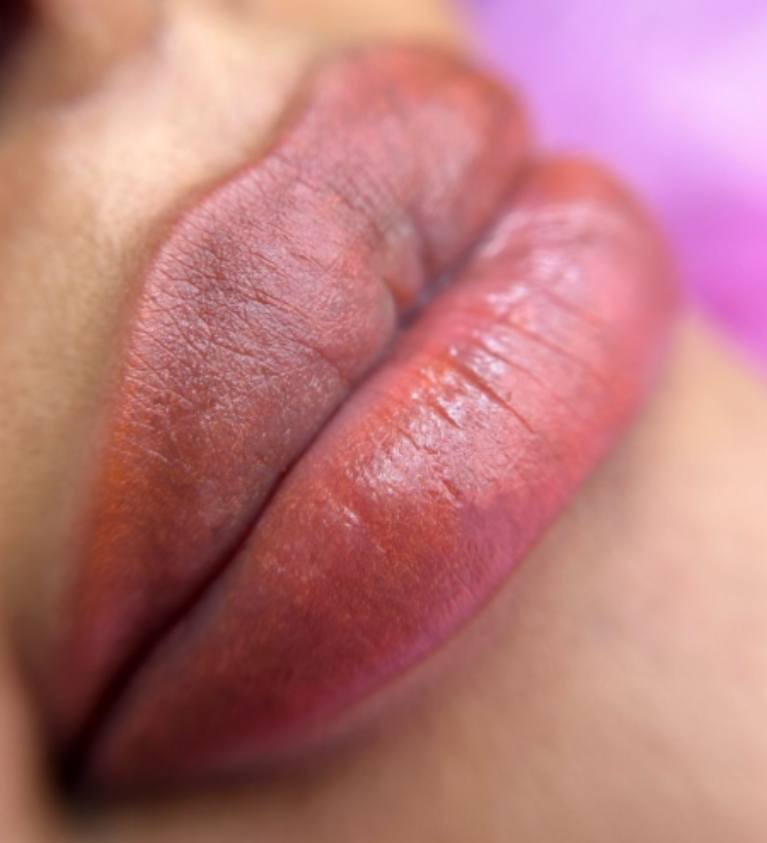 J&eacute;ssica Jim&eacute;nez - Medical & Beauty Tattoo 9