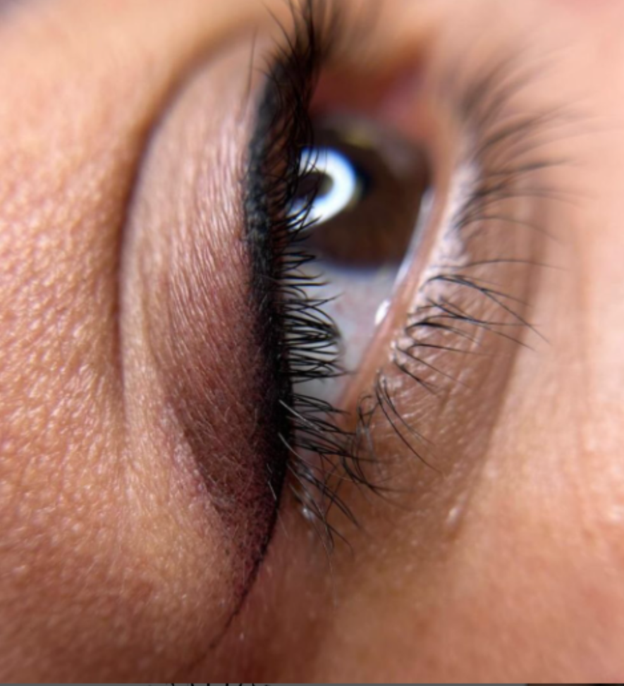 J&eacute;ssica Jim&eacute;nez - Medical & Beauty Tattoo 7